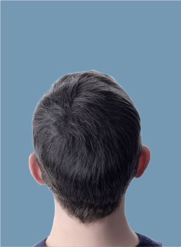 after hair growth