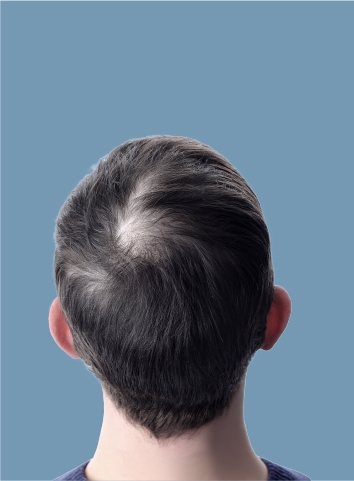 hair growth